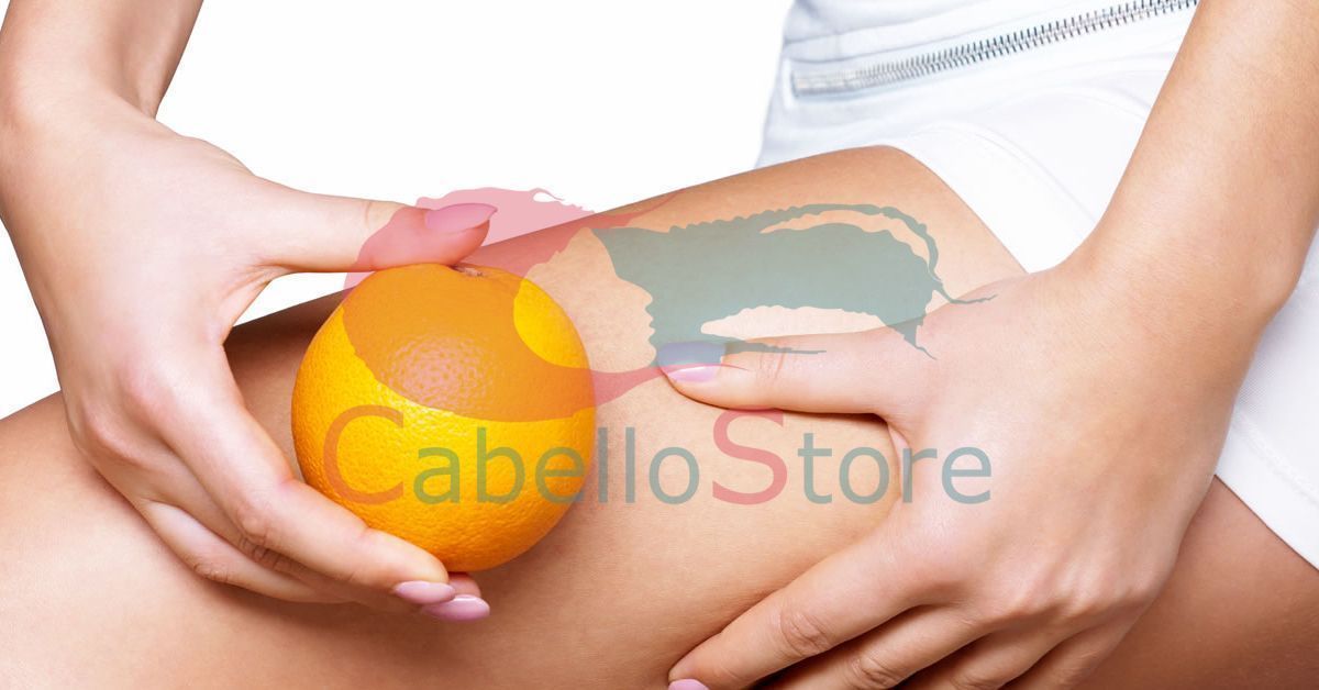 Se acerca el verano, dile adiós a la celulitis